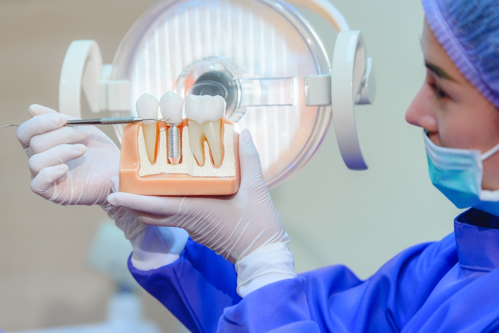 Dentist,Showing,Human,Teeth,Model,And,Pointing,To,Crown,Of